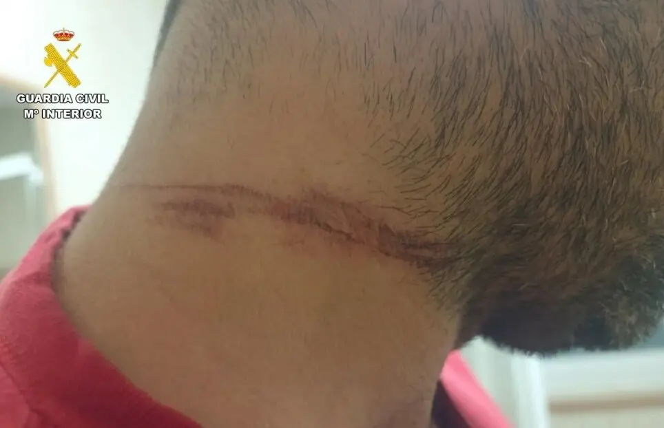 El herido