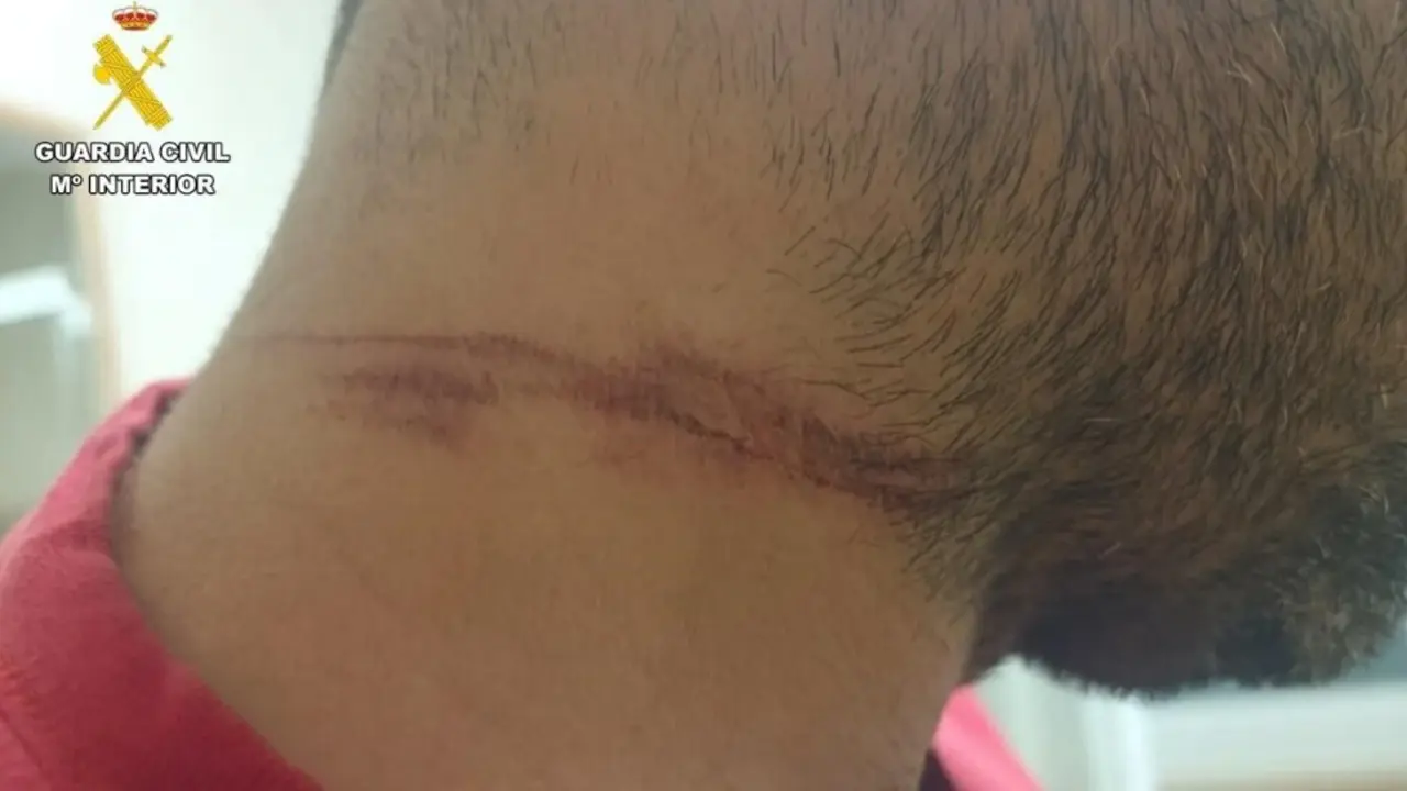 El herido